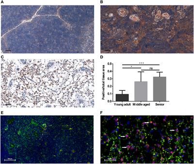 PPARgamma Deficiency Counteracts Thymic Senescence